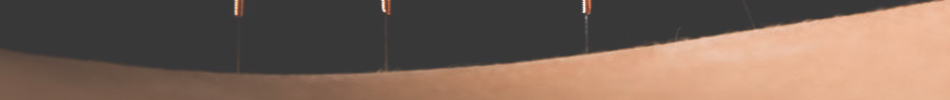 Acupuncture